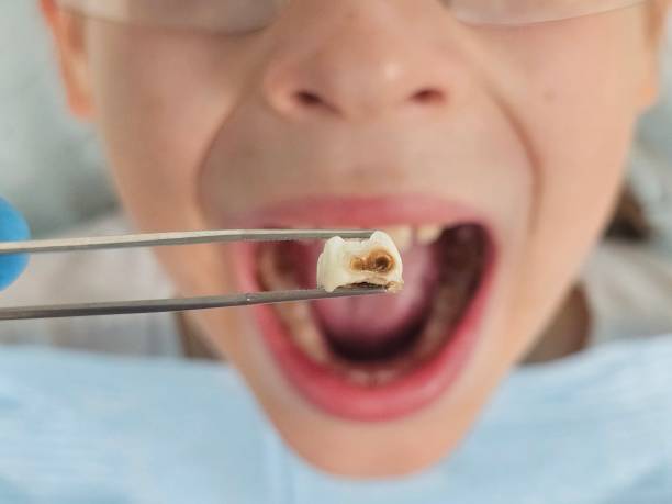 Best Pediatric Emergency Dentist in West, TX